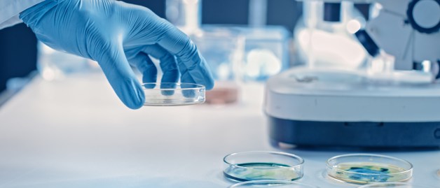 In einem Labor werden mit Bakterien bewachsene Agar-Platten untersucht.