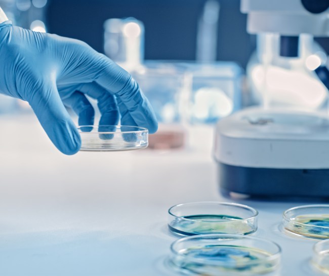 In einem Labor werden mit Bakterien bewachsene Agar-Platten untersucht.