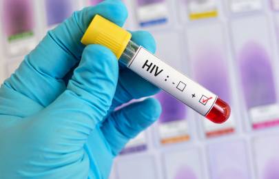 Eine Hand, die einen Gummihandschuh trägt, hält ein Reagenzglas. Darauf klebt ein Aufkleber mit der Aufschrift HIV und zwei Kästchen, die HIV negativ und HIV positiv andeuten. Das Kästchen bei HIV positiv ist angekreuzt.