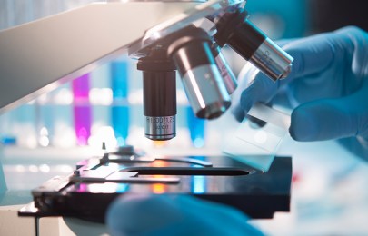 Eine Hand legt etwas unter ein Mikroskop.